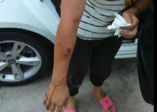 梅州一女子被天降的砂锅砸中，鲜血直流