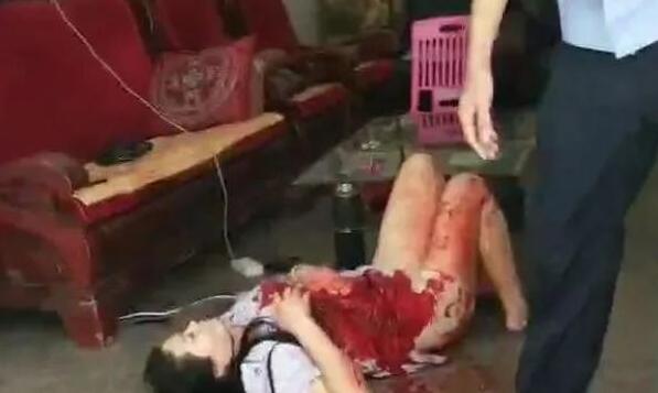 兴宁某保健店发生伤人事件，伤者身上大量血迹